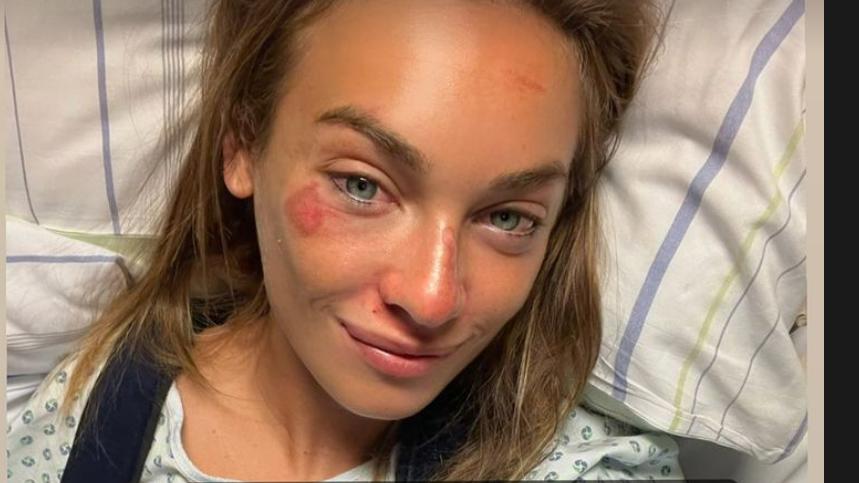 Schwer verletzt bei EM-Rennen - Klinik-Selfie nach Horror-Crash