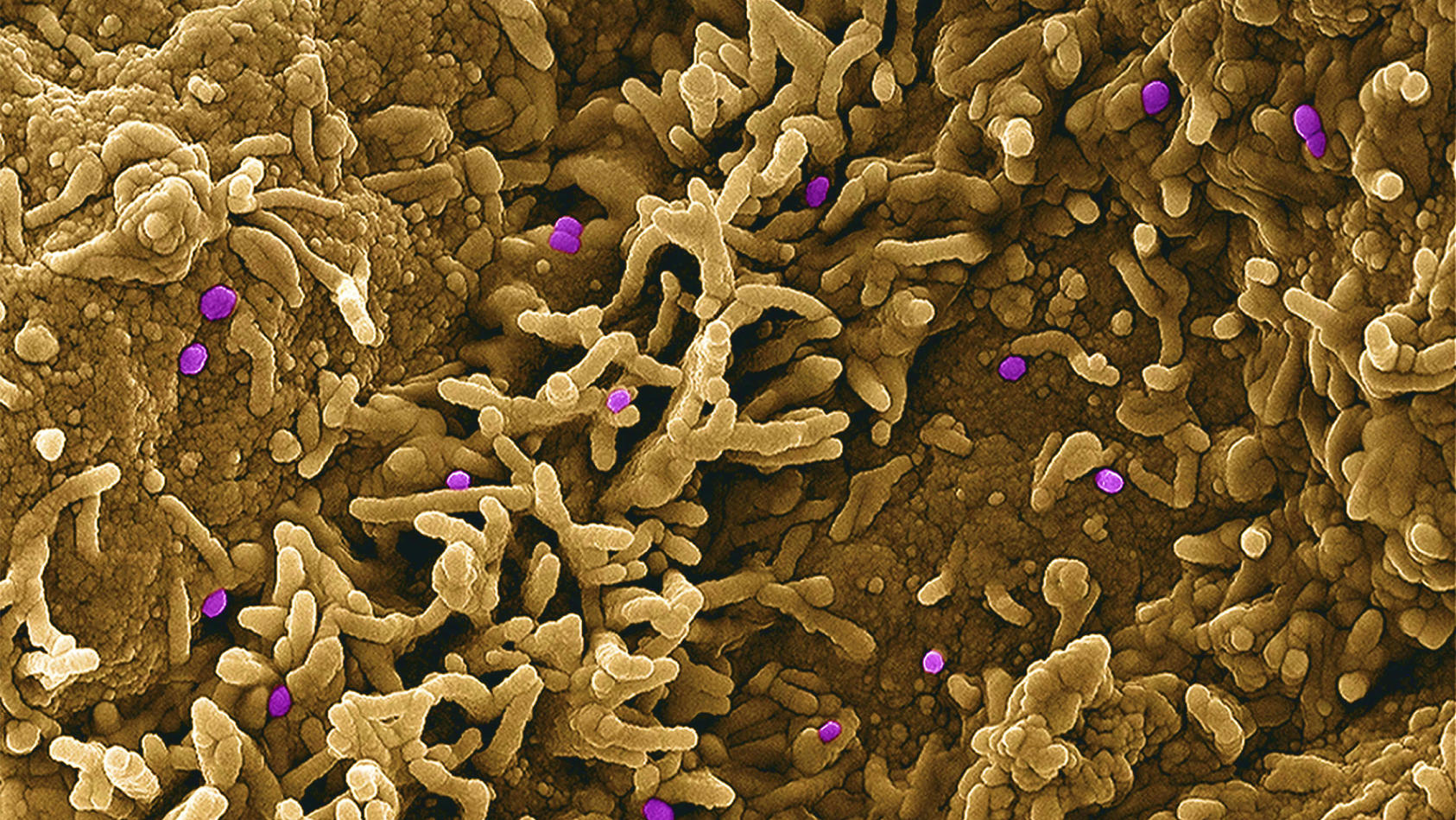 Ein koloriertes Rasterelektronenmikroskopbild des Affenpockenvirus (lila) auf der Oberfläche infizierter VERO E6-Zellen 