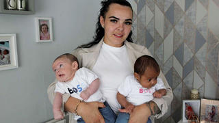 SONDERKONDITIONEN: Satzpreis!Chantelle Broughton and her twins - Azirah (darker skinned) and Ayon (fairer skinned). See SWNS story SWLNtwins. A mum was left gobsmacked after giving birth to million-to-one black and white TWINS who look like they are different races. Chantelle Broughton, 29, says she regularly gets asked 'are they both yours?' since welcoming Ayon and Azirah into the world in April. Son Ayon was born at Nottingham City Hospital with green eyes and fair skin while daughter Azirah has brown eyes and a much darker complexion. Such births are so rare, genetics experts have previously estimated them at one in a million. / action press