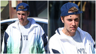Justin Bieber: Woher kommen die Sterne auf seinem Gesicht?