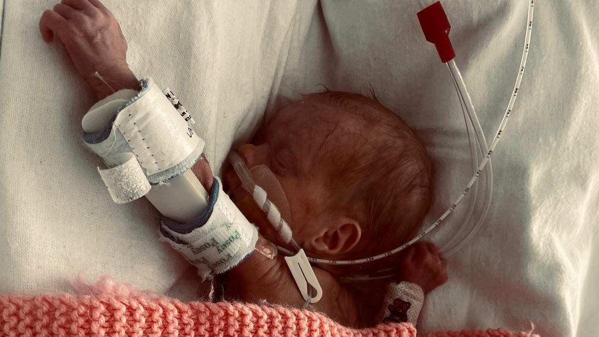 Marley Hayes kurz nach ihrer Geburt im Krankenhaus