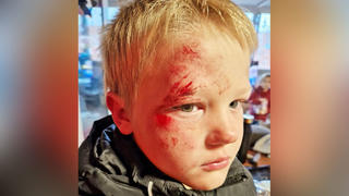 Jayden (7) spielte das "Mach mich rot"-Spiel, eine Art Variante der Blackout Challenge, und verletzte sich dabei schwer.