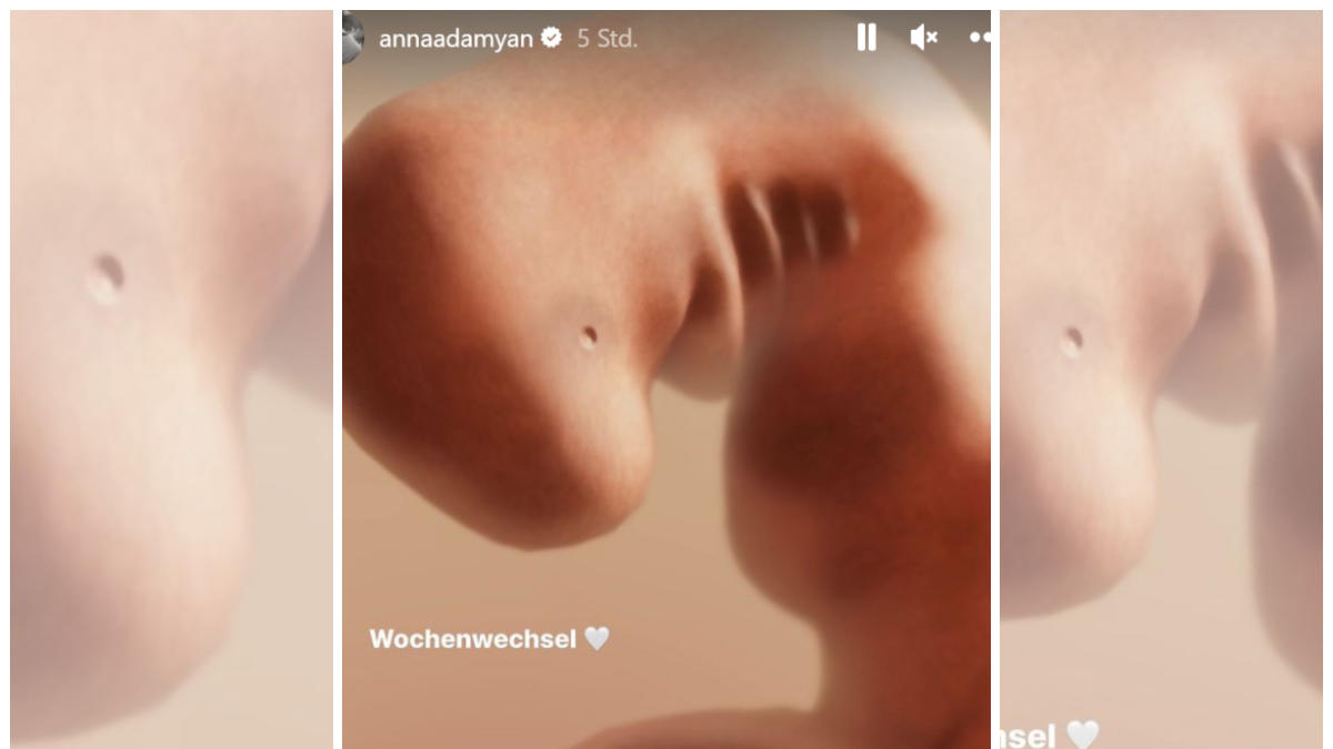 Anna Wilken zeigt App-Foto ihres Babys in der siebten Woche