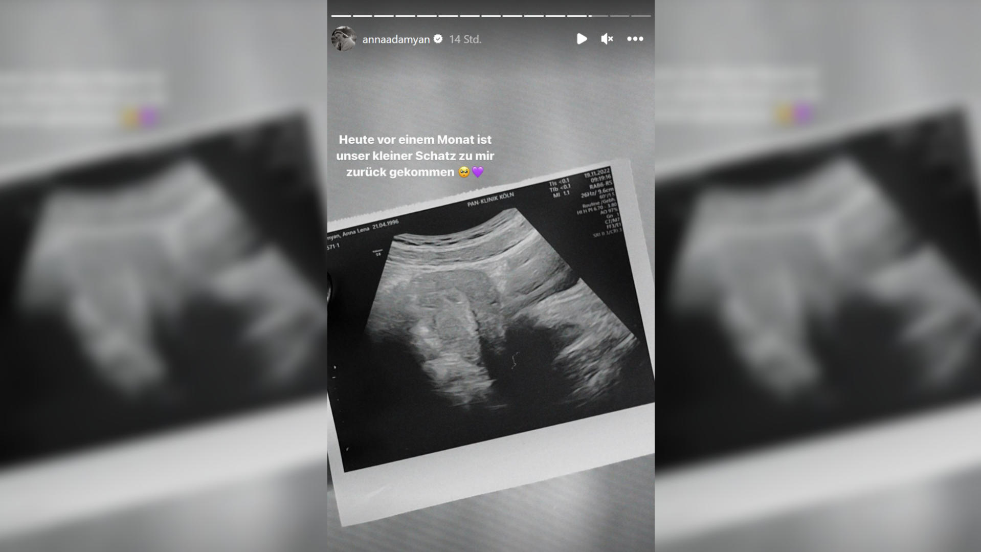 Anna Adamyan darf schon das erste, kleine Jubiläum mit ihrem ungeborenen Baby feiern und teilt ein Ultraschallbild.