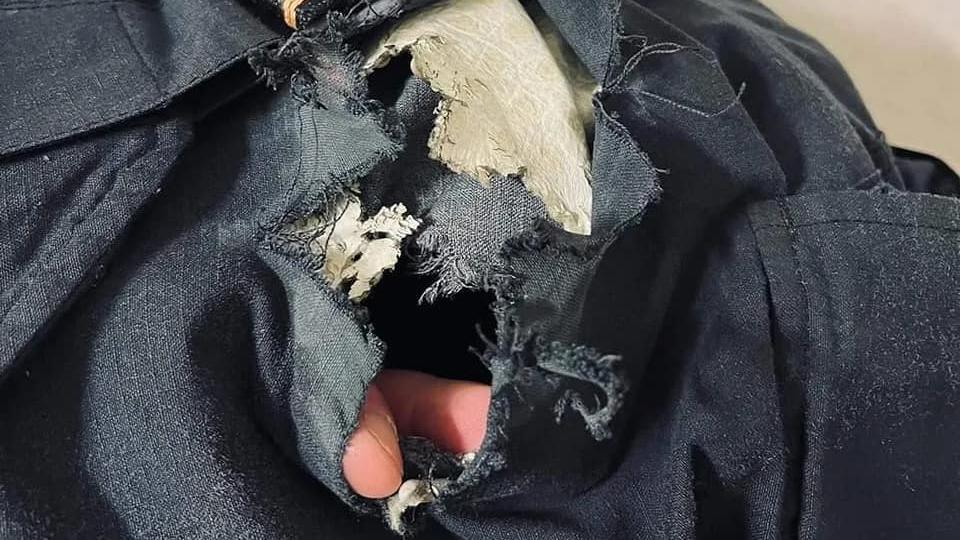 Der Böller hat sich durch die Schutzkleidung bis auf die Haut gebrannt.