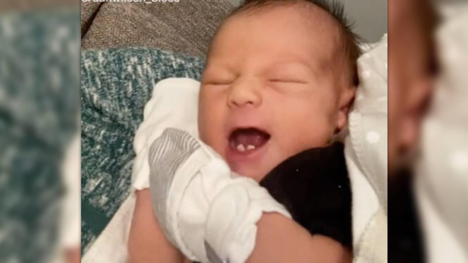 Kansas City: Baby is born with ‘witch teeth’