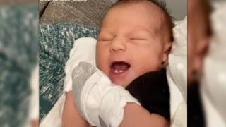 Jordan Bloss-Wilsons Sohn Dawson hat von Geburt an zwei Zähnchen.