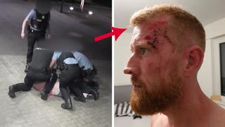 Liam Conway (38) wurde von Polizeibeamten angegriffen.