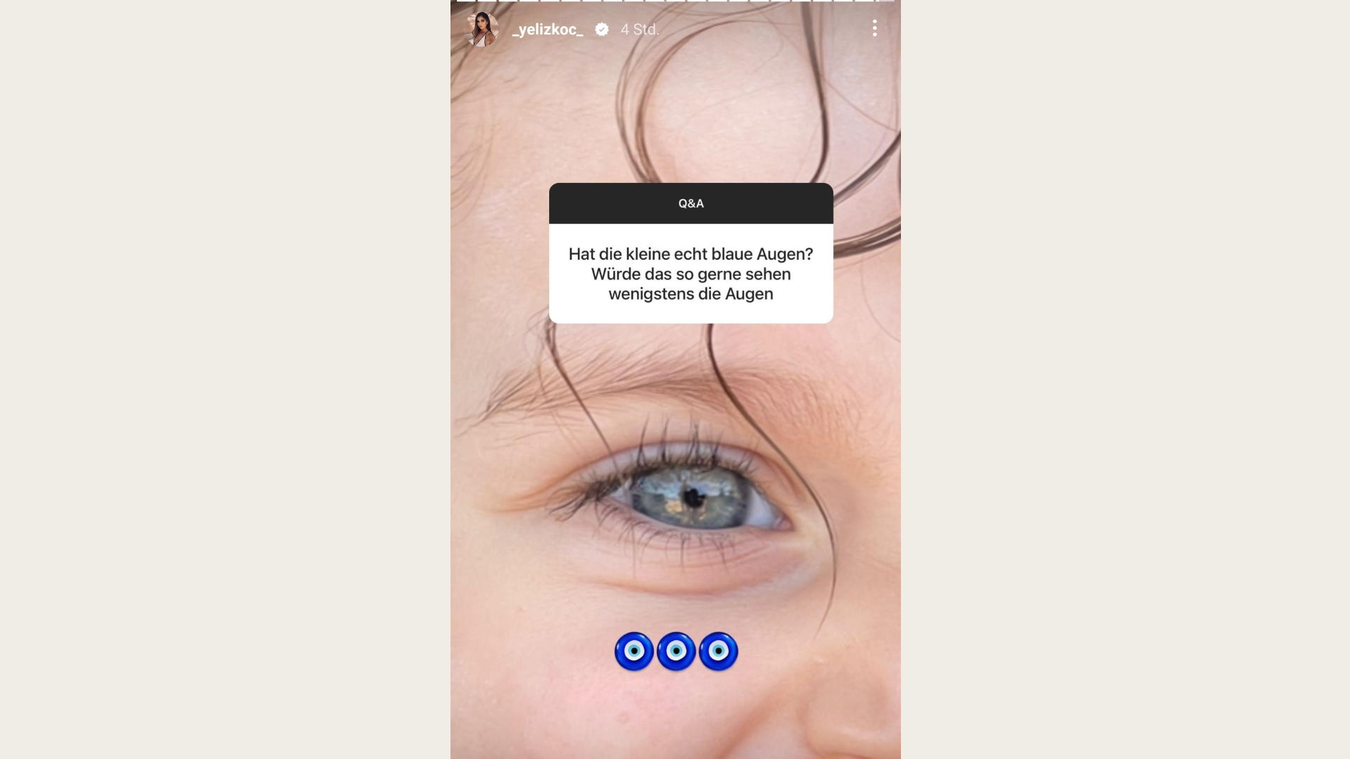 Yeliz Koc zeigt in einem Q&A auf Instagram jetzt allen, was ihre kleine Tochter für strahlende schöne blaue Augen hat. 