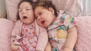 Bei Ava-Grace (4) und Henry (2) wurden Lissencephalie und Mikrozephalie diagnostiziert