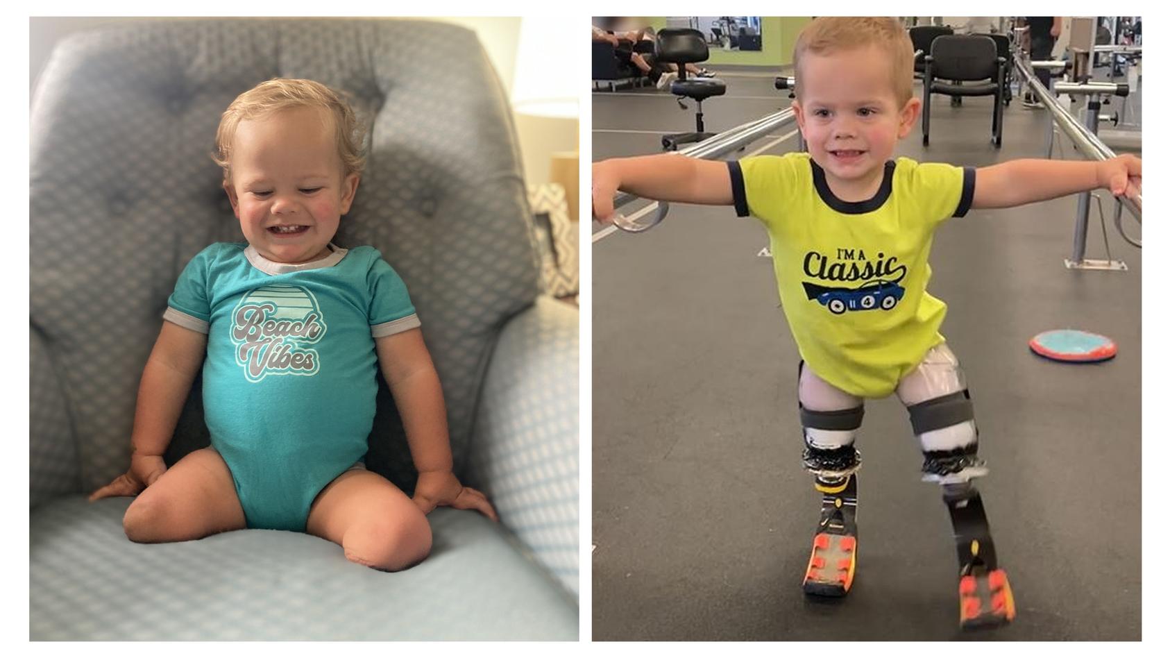 Nach seiner Operation, bei der beide Beine amputiert wurden, kann der kleine Louie Brown aus Ohio (USA) endlich laufen.