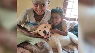 Namith aus Indien mit seltener Erkrankung