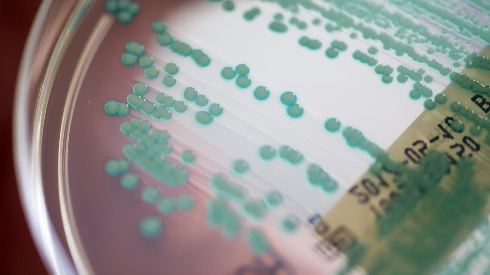 Antibiotikaresistenzen stellten heute eine der größten gesundheitlichen Herausforderungen in Europa dar.