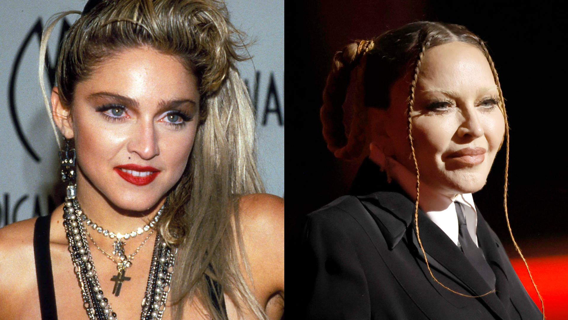 So sehr hat sich Madonna im Laufe der Jahre verändert.