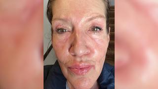 Katy Karrenbauer reagierte allergisch auf ein neues Make-up.
