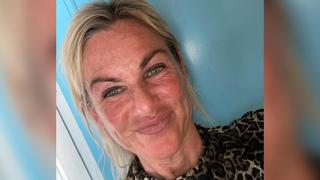 Berit Linnet im Krankenhaus wegen Lakritz-Tee