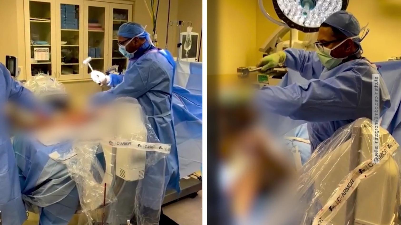 Er ist der Knochenbrecher - Beauty-Doc verlängert Beine