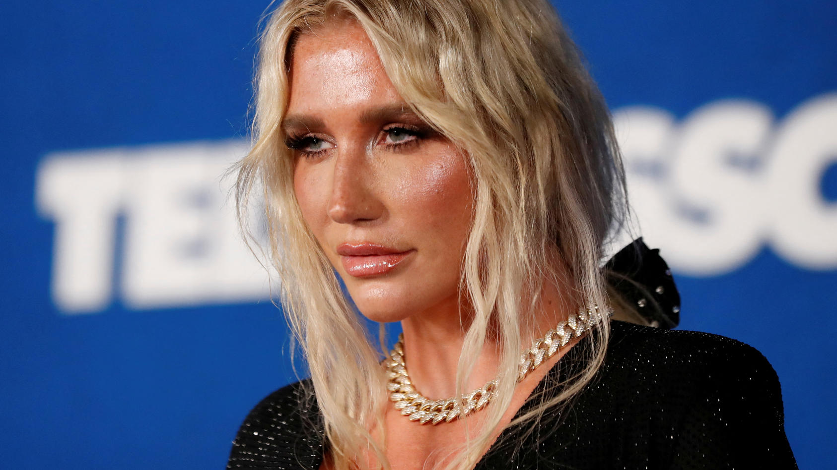 Sängerin Kesha: Komplikationen nach Kinderwunsch-OP - „Ich wäre fast