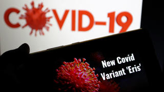 A new mutation of the Covid-19 virus has appeared, dubbed "eris". "Eris" belongs to the "Omicron" dynasty, and its symbol is "EG 5.1" It was classified as a variable and now it represents one. out of every 10 cases of COVID-19 on August 11,2023 .(Yassine Mahjoub/SIPA)//MAHJOUBYASSINE_MAHJOUB0272/Credit:Yassine Mahjoub/SIPA/2308121122