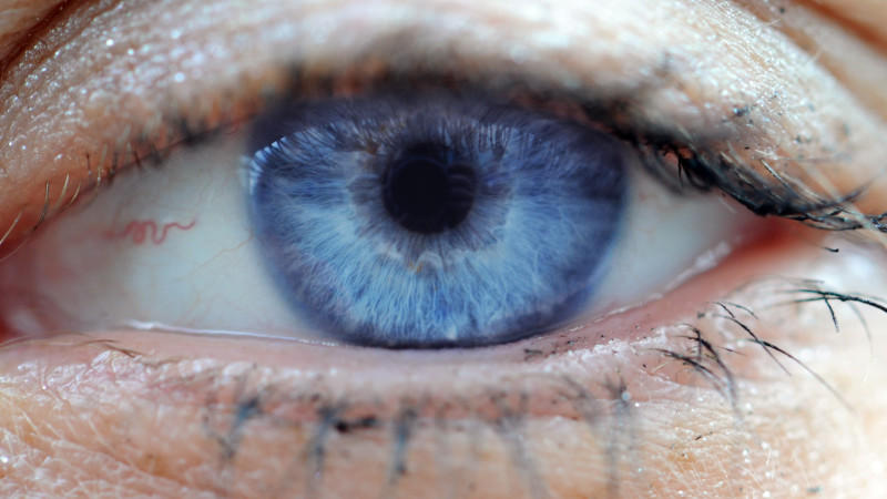 Augendiagmostik: Krankheitssymptome am Auge ablesen