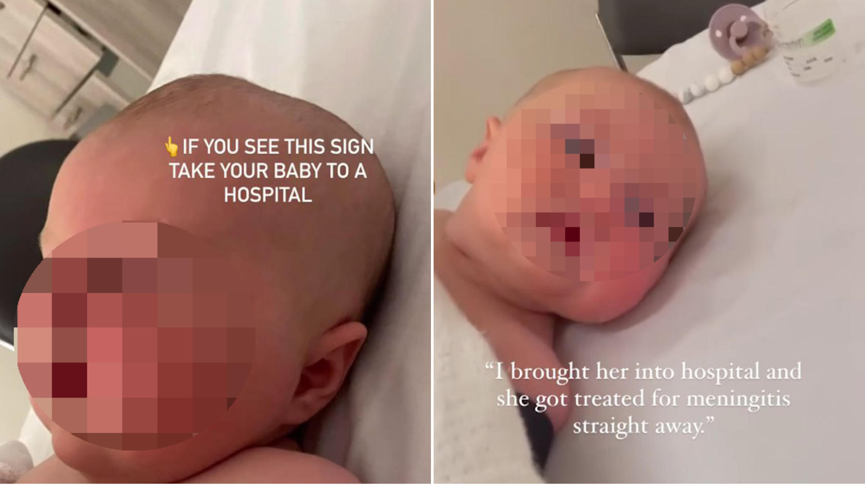 A strange bump on the baby's head turns out to be meningitis