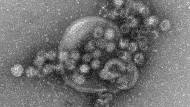 Darstellung eines Noro-Virus