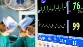 patient cardiogram monitoring in operation room EKG Herzkrankheiten Herz-Kreislauf Herzinfarkt Operation Krankenhaus