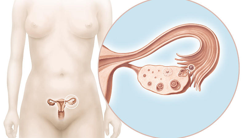 Frauen-Unterkörper und Eileiter