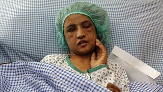 An Afghan girl who was tortured for months after refusing prostitution lies on a hospital bed in Kabul December 31, 2011. Sahar Gul, 15, was brutally tortured, beaten and locked in a toilet by her husband's family for months after she refused to become a prostitute, officials said on Saturday. She was in critical condition when she was rescued from a house in northern Baghlan province last week, and doctors said her recovery could take weeks. REUTERS/Omar Sobhani (AFGHANISTAN - Tags: CRIME LAW HEALTH TPX IMAGES OF THE DAY)