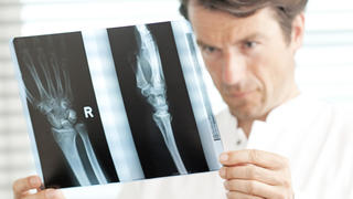 ILLUSTRATION - Ein Arzt betrachtet am 29.05.2012 in einem Behandlungszimmer in Berlin ein Röntgenbild.
