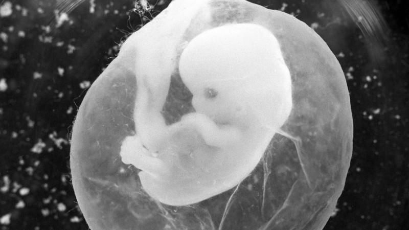 ARCHIV - Das undatierte Foto zeigt einen sieben Wochen alten Fötus in einer Fruchtblase. Erstmals seit Jahren ist die Zahl der Schwangerschaftsabbrüche in Deutschland wieder spürbar angestiegen. Wie das Statistische Bundesamt in Wiesbaden am Freitag 