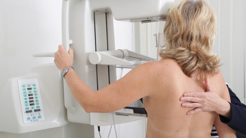 Viele Frauen gehen jährlich zur Mammographie