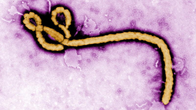 Das Ebola-Virus breitet sich aus: Ist nun auch die arabische Welt betroffen?