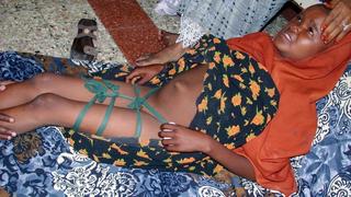 Fay Mohammad liegt am 8.3.2004 auf einer Decke in Mogadischu. Sie ist neun Jahre alt und vor fünf Tagen beschnitten worden. Ihre Beine wurden zusammengebunden, damit die Wunde ruhig gestellt ist und besser heilen kann. Sie liegt ganz still, jede Bewegung scheint ihr wehzutun. «Ich habe sie beschneiden lassen, weil es bei uns so üblich ist», sagt ihre Mutter. Der Eingriff habe umgerechnet etwa zwei Euro gekostet. Vier Wochen muss das Mädchen so liegen. In Somalia sind 98 Prozent aller Frauen genital verstümmelt. Der Kampf gegen die Beschneidung von Mädchen hat in Somalia gerade erst begonnen. Da in dem Bürgerkriegsland völlige Anarchie herrscht, sind es Frauengruppen, die mit geringen Mitteln versuchen, diesen Brauch abzuschaffen. Zum internationalen Tag der Frau am 8. März begannen sie ihre erste landesweite Kampage.