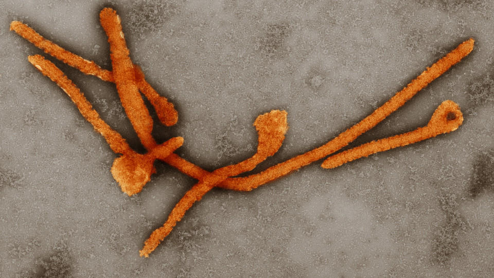 In Schottland hat sich ein Ebola-Verdachtsfall bestätigt.