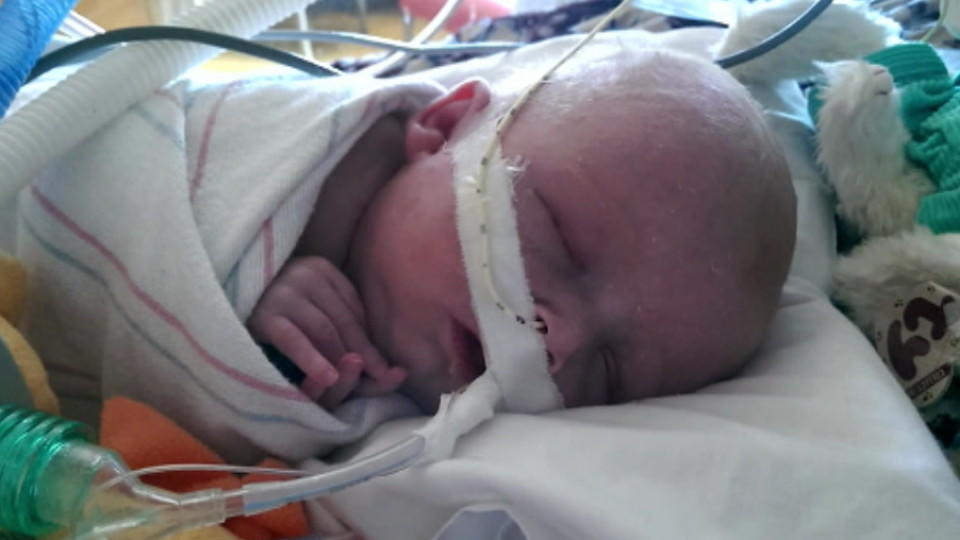 Herz war viel zu groß: Baby nach Zehn-Stunden-OP gerettet