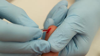 ARCHIV - ILLUSTRATION - Einem Mann nimmt am 14.06.2012 eine Blutprobe für eine Untersuchung ab. Foto: Tim Brakemeier/dpa (zu dpa "Spuren im Blut: Test fahndet effektiv nach Hunderten Viren" vom 04.06.2015) +++(c) dpa - Bildfunk+++