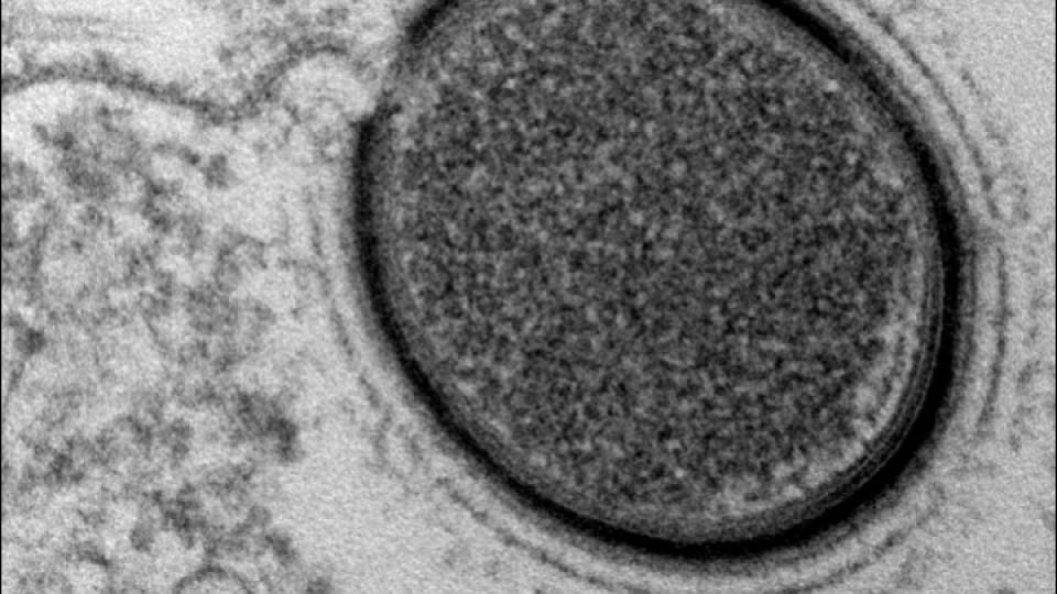 Forscher haben in Sibirien ein uraltes Virus im Permafrost entdeckt.