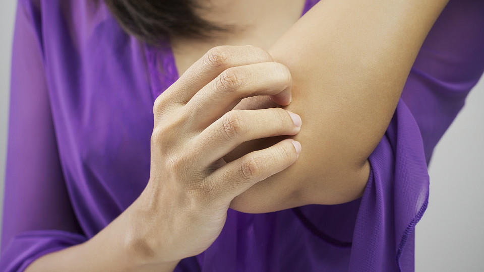 Hautallergien sind unangenehm. Viele Allergiker leiden unter dem Juckreiz.
