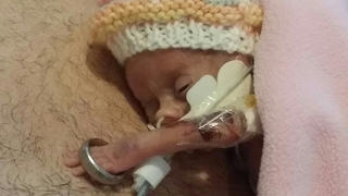 PIC FROM CATERS NEWS - (PICTURED: Mollie Perrin in hospital at 25 days old. This is the first time her father James held her, she was so small her arm slid into her fathers wedding ring.  Mollie Perrin was born at 1lb 1oz in April only given three weeks to live,) --Here are the adorable photos of a miracle 1lb baby girl celebrating her first Christmas after defying the odds to survive. Mollie Perrins parents Stephanie, 34, and James, 38, from Hull, East Yorks, were told to expect the worst on April 27 when their daughter was born three -months premature. A picture of Mollie with her dads wedding ring around her arm- illustrating how tiny she was - went viral earlier in the year. And after 20 weeks in hospital Mollie defied the odds and has finally been allowed home. She now weighs 8lbs and is preparing to spend her first Christmas with her family, a moment they never thought theyd share. SEE CATERS COPY.