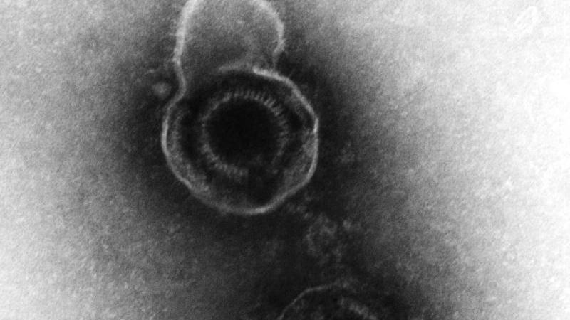 Das Varicella-Zoster-Virus, das Gürtelrose (Herpes zoster) auslösen kann