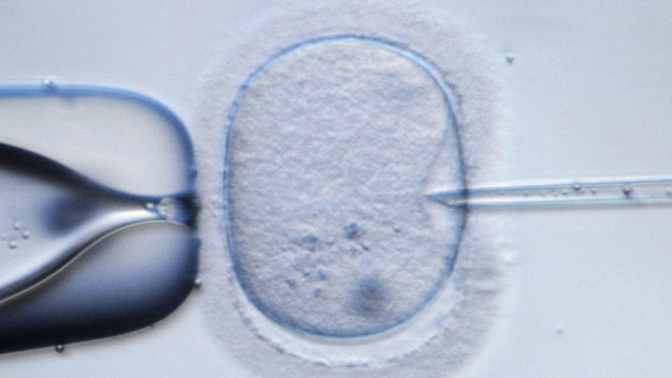 Mikroskopische Aufnahme einer menschlichen Eizelle, die injiziert wird 