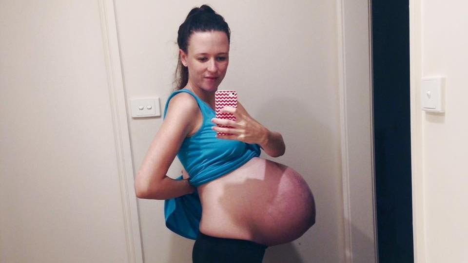 Babybauchfoto: Schwangere fotografiert sich