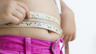 Fettleibigkeit, Adipositas, dick, Kinder, Übergewicht 