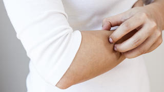 Caucasian woman is scratching her arm. Torso of woman with white shirt and jeans is shown under natural light, horizontal