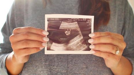 Bloggerin Ana Craft zeigt das Ultraschallbild ihrer Tochter Karis Olivia