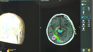 neuroblastom-bei-kindern-was-steckt-wirklich-hinter-dieser-krankheit