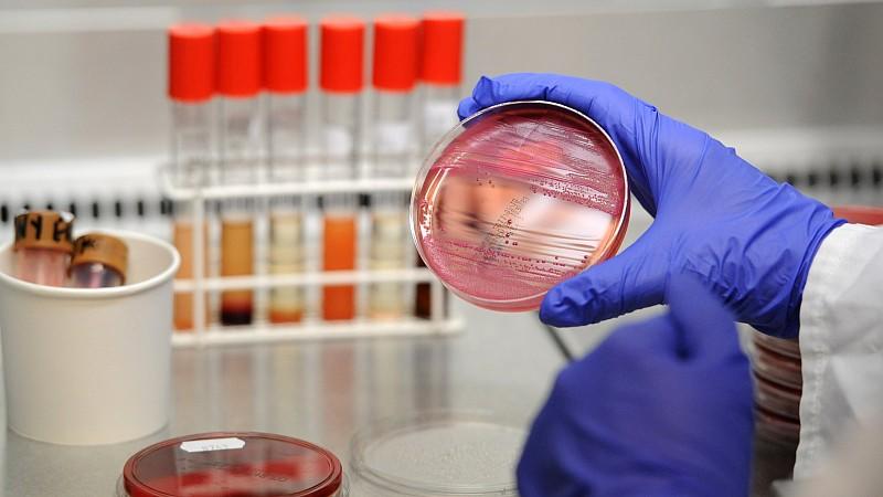 Eine Medizinisch-Technische Assistentin (MTA) arbeitet am Dienstag (24.05.2011) unter einer Abzugshaube im Universitätsklinikum Hamburg-Eppendorf (UKE) an Stuhlproben, die auf EHEC-Bakterienstämme untersucht werden. Die Zahl von blutigen Durchfallerk