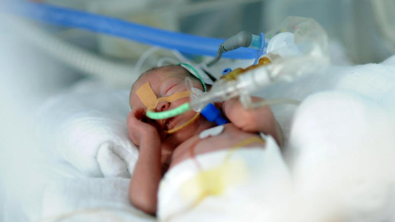 Ein zu  früh geborenes Baby liegt am 05.02.2013 in Berlin in der Neonatologie der Charité in einem Inkubator. Foto: Britta Pedersen