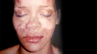 Rihanna nach der Prügelattacke